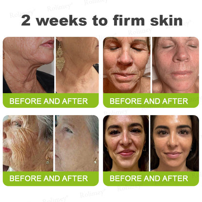 ❤️👑Made and shipped from Australia 💫Rolimey® Botox & Vita-A Retinol Shot Wrinkle-Lift Tightening cream - Last Day Promotion 50% OFF