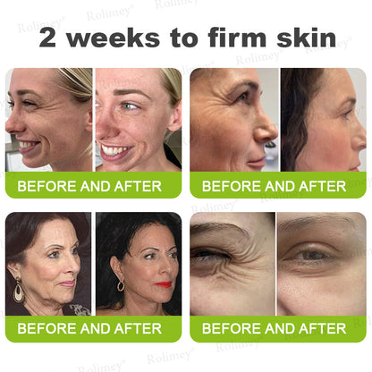 ❤️👑Made and shipped from Australia 💫Rolimey® Botox & Vita-A Retinol Shot Wrinkle-Lift Tightening cream - Last Day Promotion 50% OFF