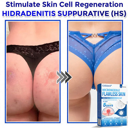 ☘️☘️Celsiora® 2-in-1 Microneedle & Hydrocolloid Patch | Raised Moles,Acne, Flat Warts & Skin Tags Remover | Improves Wrinkles, Scars & Blemishes | Invisible Pimple Patches for Face & Body | 24 Count