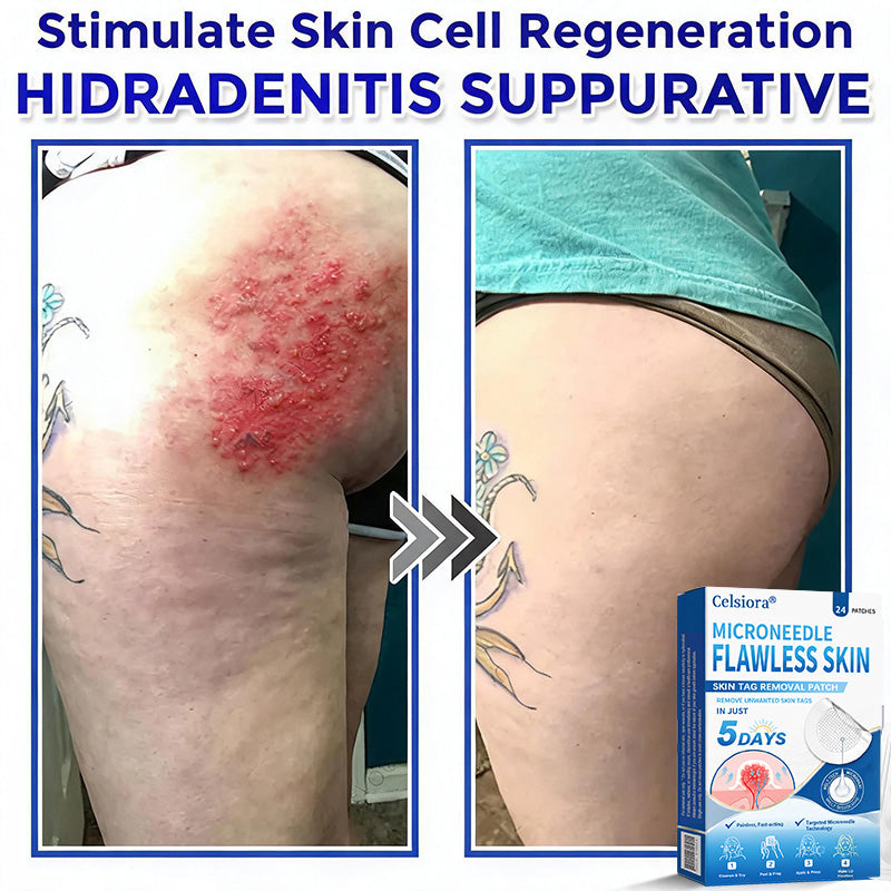 ☘️☘️Celsiora® 2-in-1 Microneedle & Hydrocolloid Patch | Raised Moles,Acne, Flat Warts & Skin Tags Remover | Improves Wrinkles, Scars & Blemishes | Invisible Pimple Patches for Face & Body | 24 Count