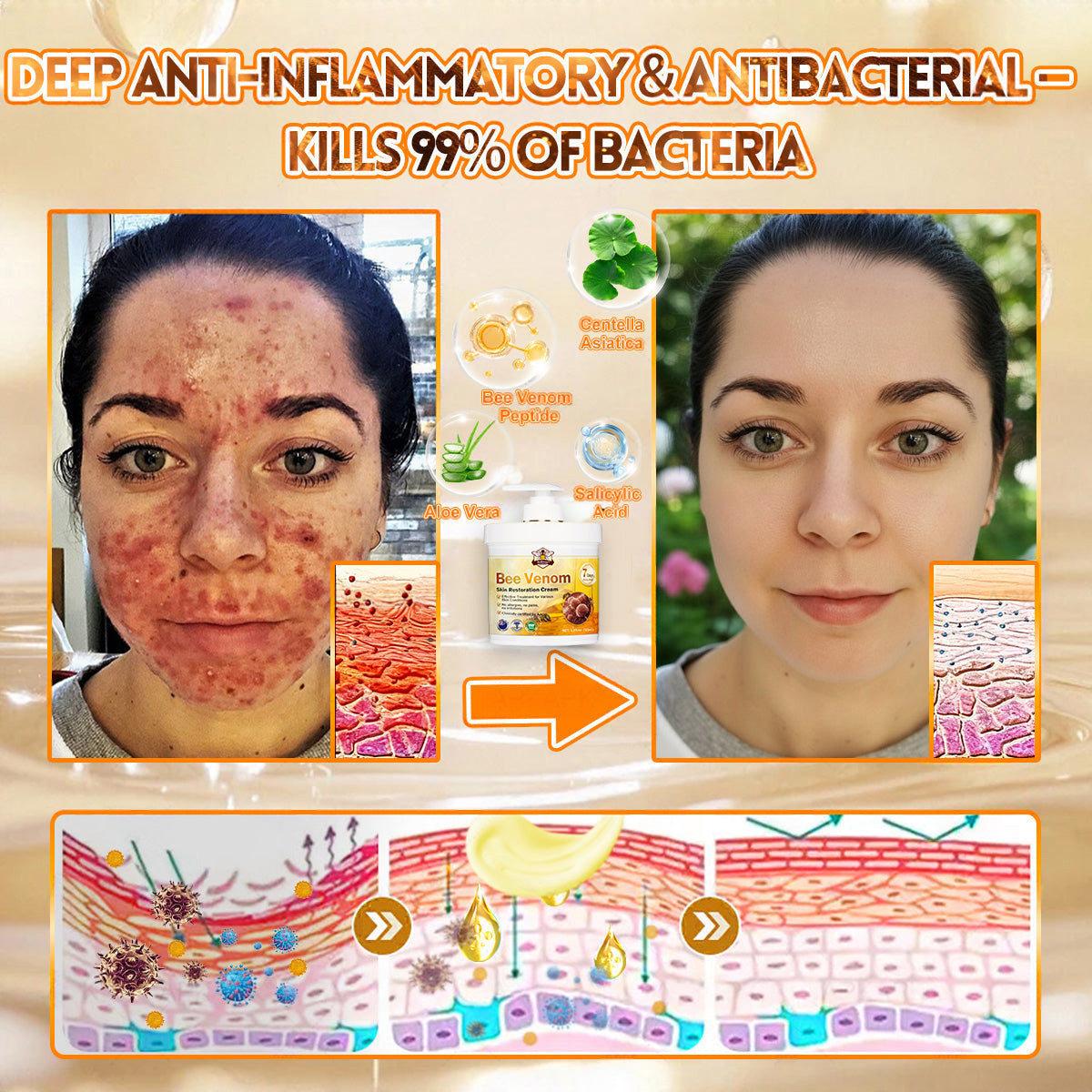 👨‍⚕️🌟Rolimey® Bee Venom Skin Restoration Cream(Anti-aging, Hydrating, Skin Repair, Even Tone, Acne and Dark Spot Treatment, Wart and Mole Removal, Psoriasis Relie)
