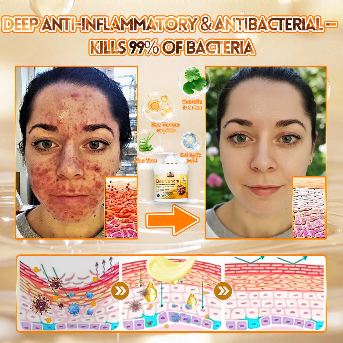 👨‍⚕️Rolimey® Bee Venom Skin Restoration Cream (Anti-aging, Hydrating, Skin Repair, Even Tone, Acne and Dark Spot Treatment, Wart and Mole Removal, Psoriasis Relief)