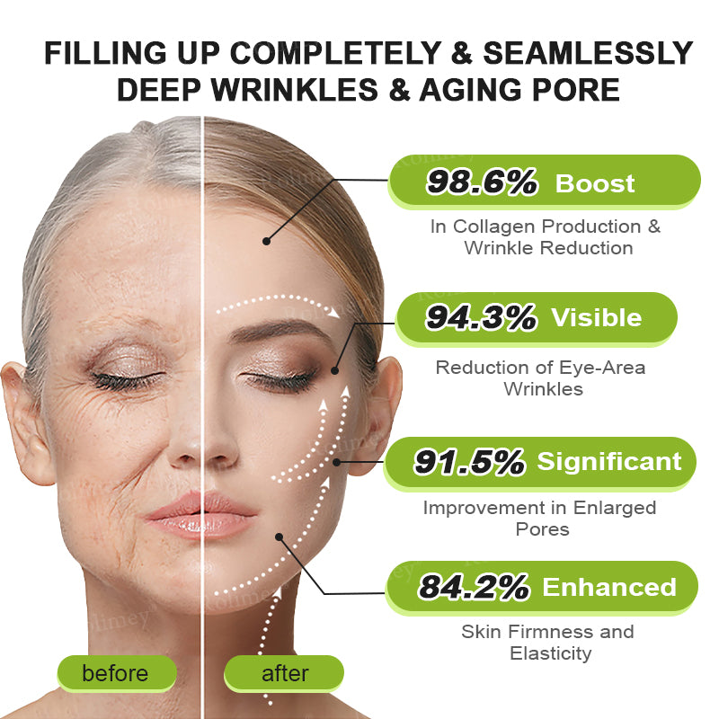❤️👑Made and shipped from Australia 💫Rolimey® Botox & Vita-A Retinol Shot Wrinkle-Lift Tightening cream - Last Day Promotion 50% OFF