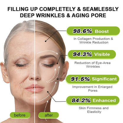 ❤️👑Made and shipped from Australia 💫Rolimey® Botox & Vita-A Retinol Shot Wrinkle-Lift Tightening cream - Last Day Promotion 50% OFF