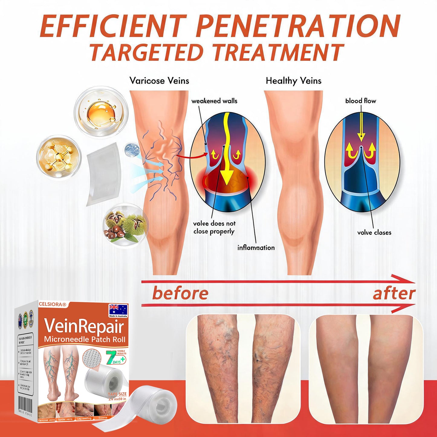 🌟🌟Celsiora® Vein Ease Microneedle Care Patch(For Spider Veins, Varicose Veins, Swelling & Leg Fatigue) - Last Day Promotion 50% OFF