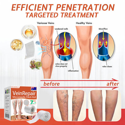 🌟🌟Celsiora® Vein Ease Microneedle Care Patch(For Spider Veins, Varicose Veins, Swelling & Leg Fatigue) - Last Day Promotion 50% OFF