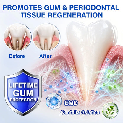 🇦🇺🌿🦷 Evolvion® GumCare Pro Advanced Gum Care Gel
