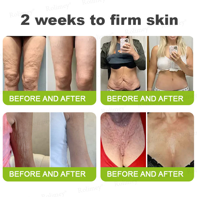 ❤️👑Made and shipped from Australia 💫Rolimey® Botox & Vita-A Retinol Shot Wrinkle-Lift Tightening cream - Last Day Promotion 50% OFF