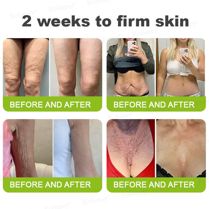 ❤️👑Made and shipped from Australia 💫Rolimey® Botox & Vita-A Retinol Shot Wrinkle-Lift Tightening cream - Last Day Promotion 50% OFF