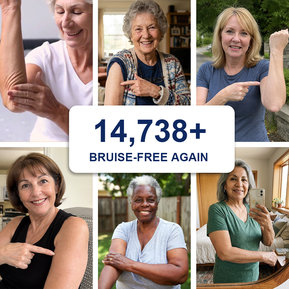 👩‍⚕️🌿Evolvion® Bruise Repair Cream-Advanced daily care for bruise-prone skin