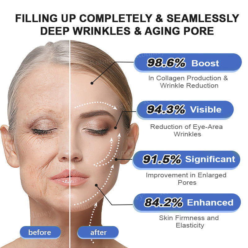 🎁🫧Rolimey® Anti-Wrinkle Firming & Lifting Cream Retinol + Collagen Peptides for Smoother, Firmer-Looking Skin | 60% OFF