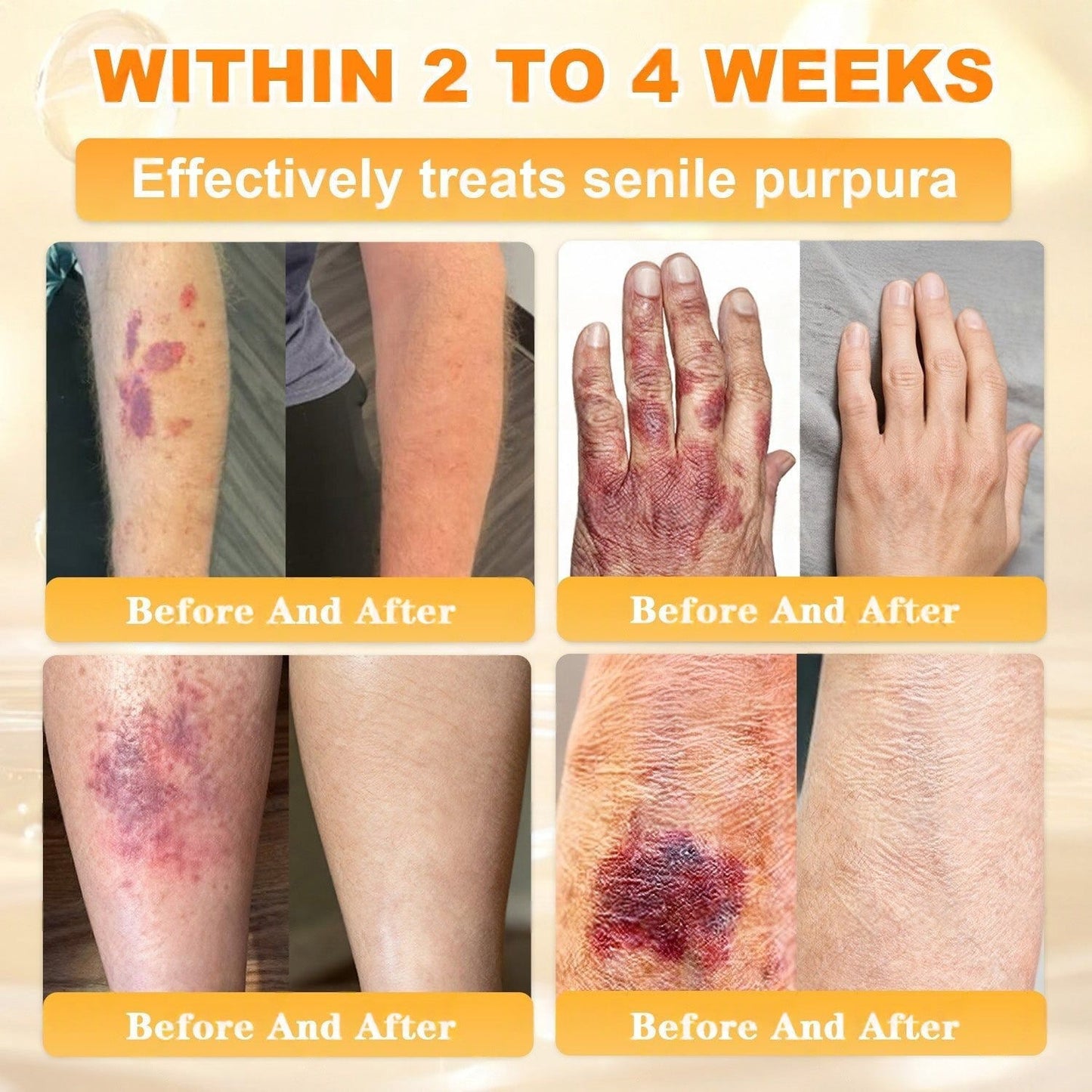 👨‍⚕️Rolimey® Bee Venom Skin Restoration Cream (Anti-aging, Hydrating, Skin Repair, Even Tone, Acne and Dark Spot Treatment, Wart and Mole Removal, Psoriasis Relief)