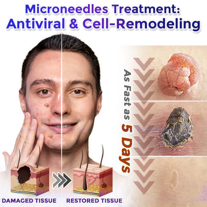 ☘️☘️Celsiora® 2-in-1 Microneedle & Hydrocolloid Patch | Raised Moles,Acne, Flat Warts & Skin Tags Remover | Improves Wrinkles, Scars & Blemishes | Invisible Pimple Patches for Face & Body | 24 Count