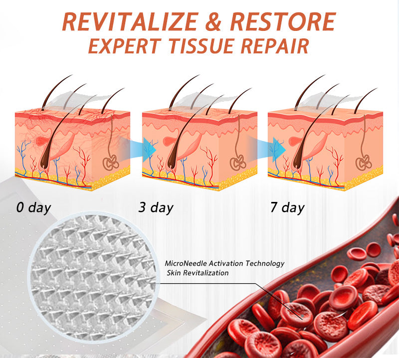 👨‍⚕️🌿Zvoevo® Vein Ease Microneedle Care Patch(For Spider Veins, Varicose Veins, Swelling & Leg Fatigue) - Last Day Promotion 50% OFF