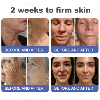 🎁🫧Rolimey® Anti-Wrinkle Firming & Lifting Cream Retinol + Collagen Peptides for Smoother, Firmer-Looking Skin | 60% OFF