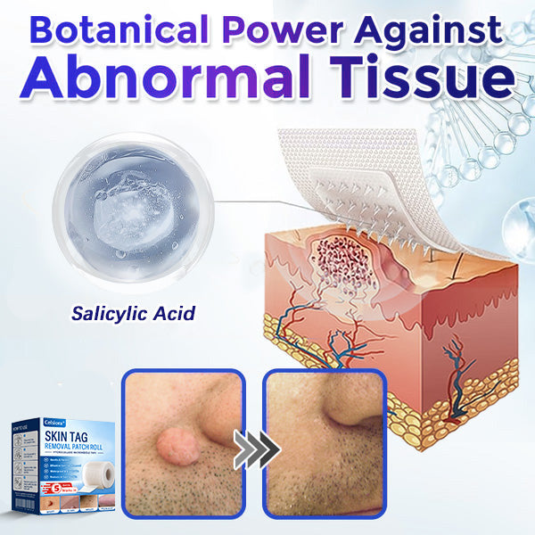 👩‍⚕️👩‍⚕️Celsiora® Multi-Functional Microneedle Hydrocolloid Patch Roll | Targets Skin Tags, Warts & Stubborn Blemishes