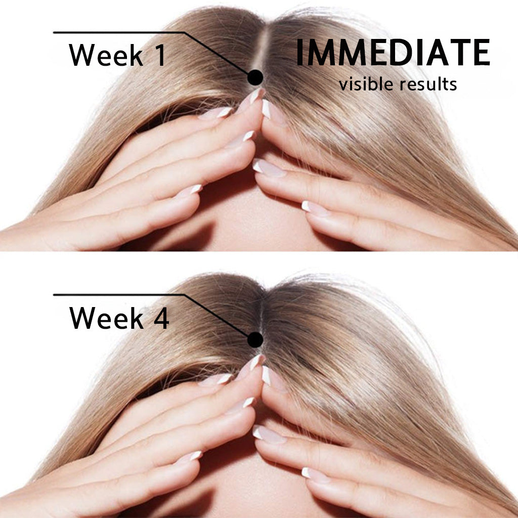 🌿🌿 Official AU Store 🇦🇺 | 🔥Rolimey® Highly Effective Biotin & Rosemary Hair Growth Serum — (🔥 Limited-Time Offer, ⏳ Last Day Promotion 50% OFF)
