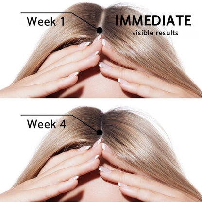 🌿🌿 Official AU Store 🇦🇺 | 🔥Rolimey® Highly Effective Biotin & Rosemary Hair Growth Serum — (🔥 Limited-Time Offer, ⏳ Last Day Promotion 50% OFF)