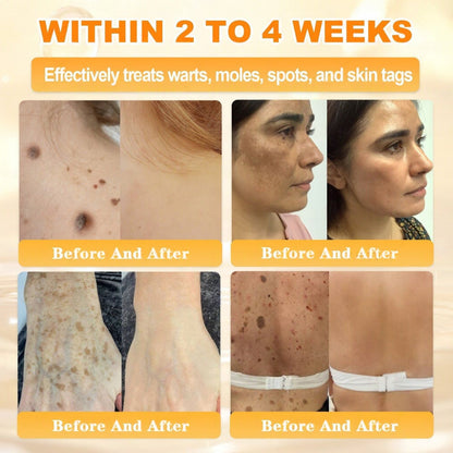 👨‍⚕️Rolimey® Bee Venom Skin Restoration Cream (Anti-aging, Hydrating, Skin Repair, Even Tone, Acne and Dark Spot Treatment, Wart and Mole Removal, Psoriasis Relief)