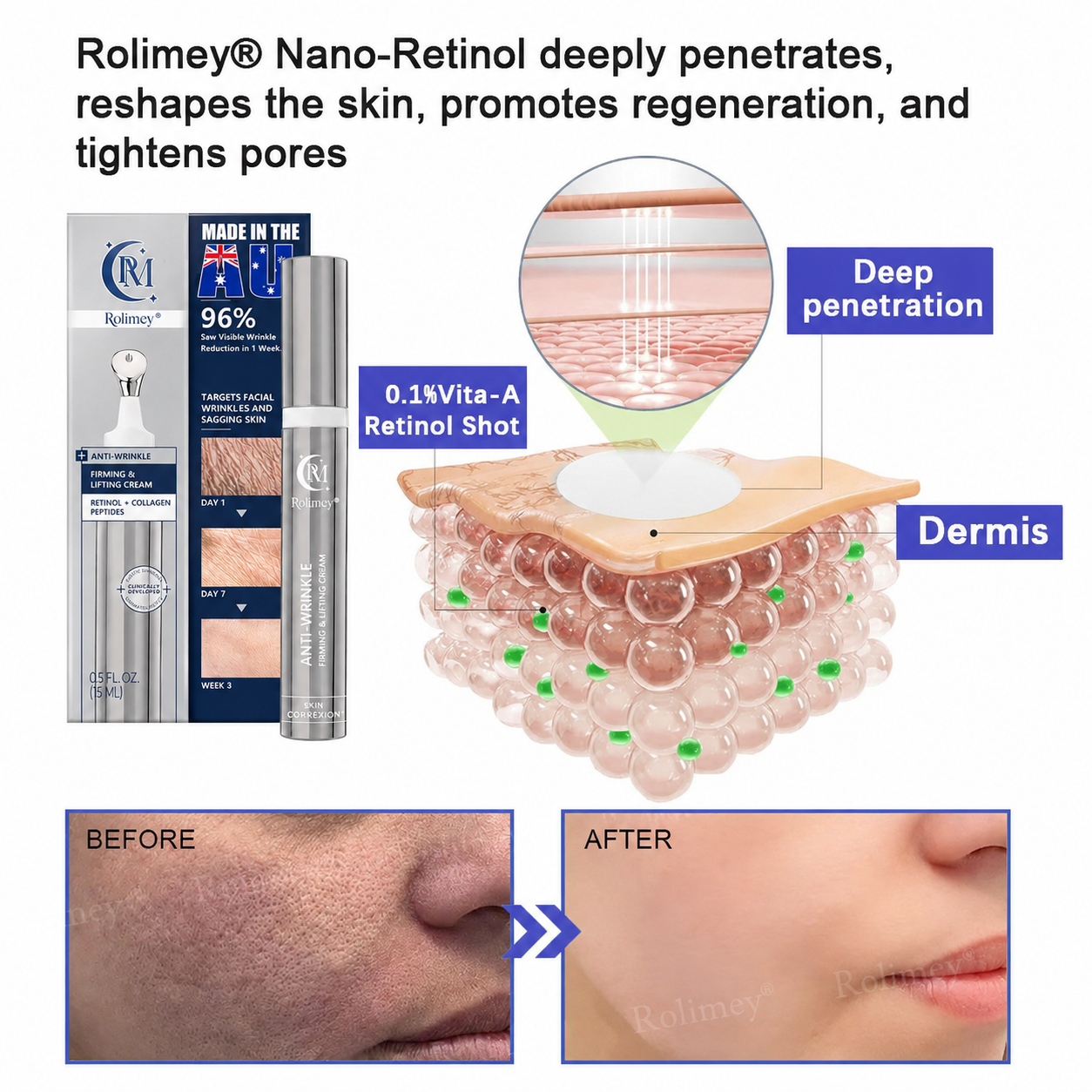 🎁🫧Rolimey® Anti-Wrinkle Firming & Lifting Cream Retinol + Collagen Peptides for Smoother, Firmer-Looking Skin | 60% OFF