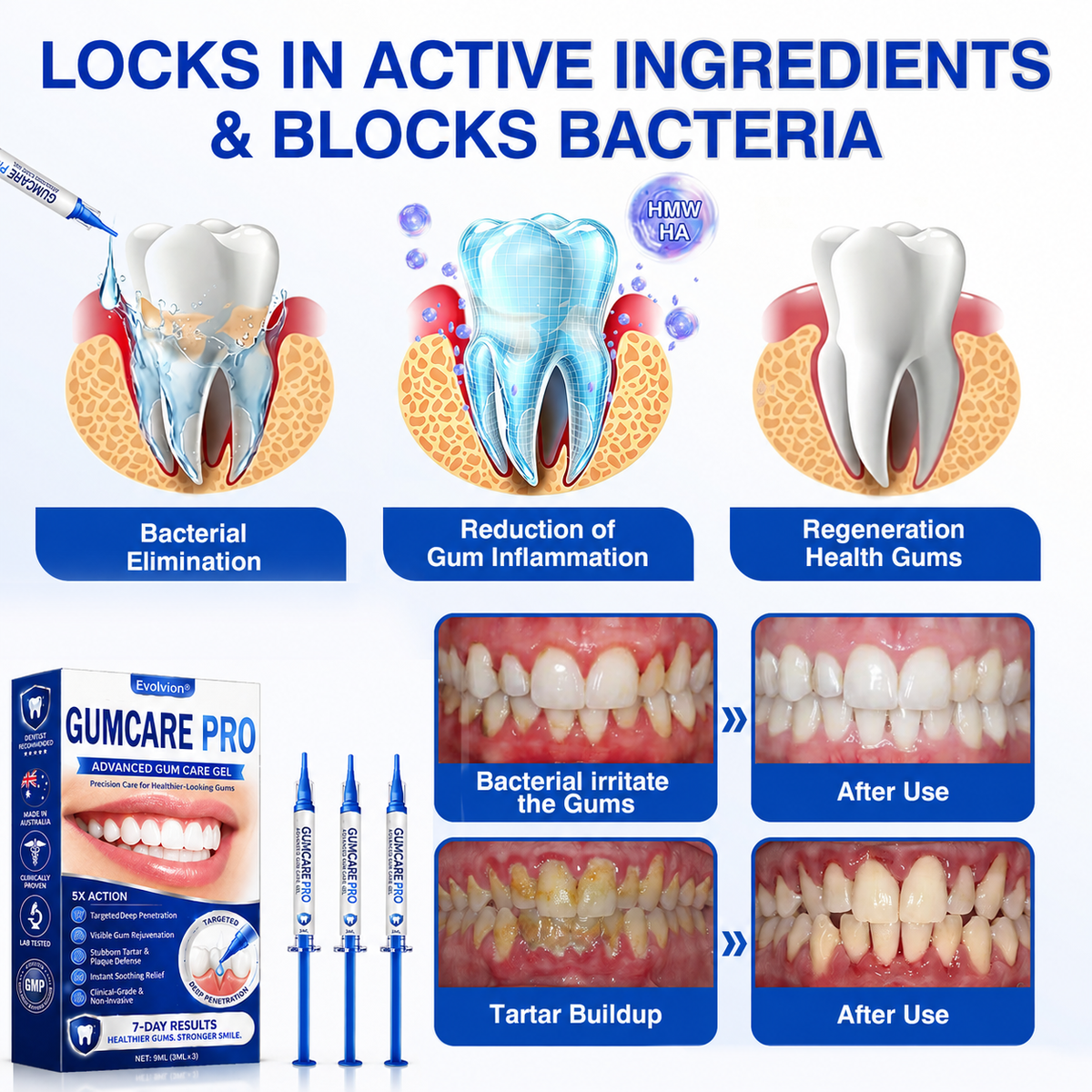 🇦🇺🌿🦷 Evolvion® GumCare Pro Advanced Gum Care Gel