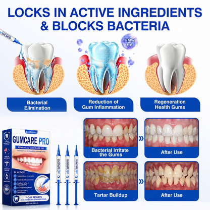 🇦🇺🌿🦷 Evolvion® GumCare Pro Advanced Gum Care Gel