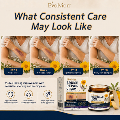 👩‍⚕️🌿Evolvion® Bruise Repair Cream-Advanced daily care for bruise-prone skin