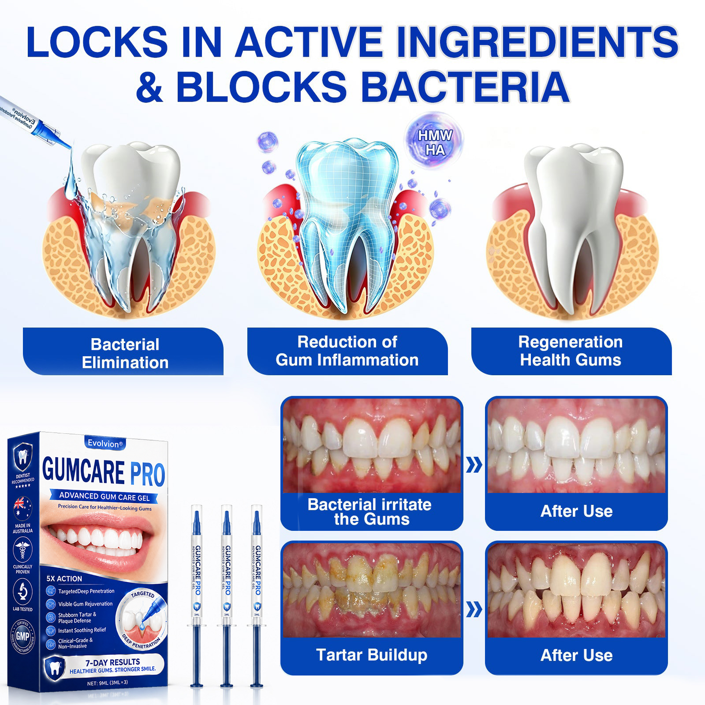 🇦🇺🌿🦷 Evolvion® GumCare Pro Advanced Gum Care Gel