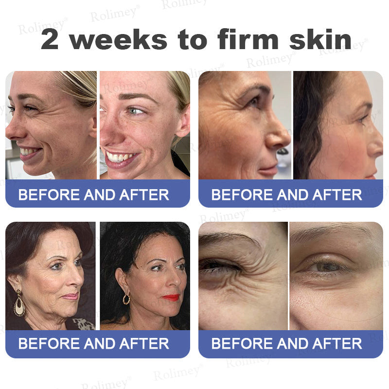 🎁🫧Rolimey® Anti-Wrinkle Firming & Lifting Cream Retinol + Collagen Peptides for Smoother, Firmer-Looking Skin | 60% OFF