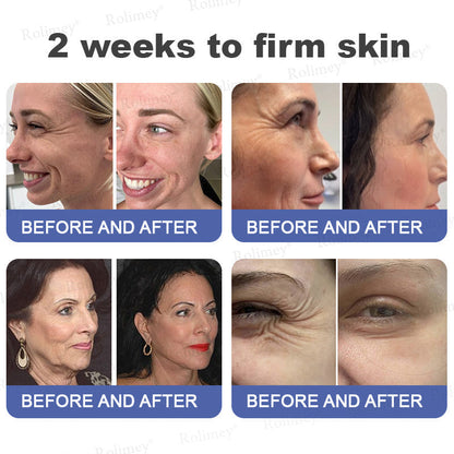 🎁🫧Rolimey® Anti-Wrinkle Firming & Lifting Cream Retinol + Collagen Peptides for Smoother, Firmer-Looking Skin | 60% OFF