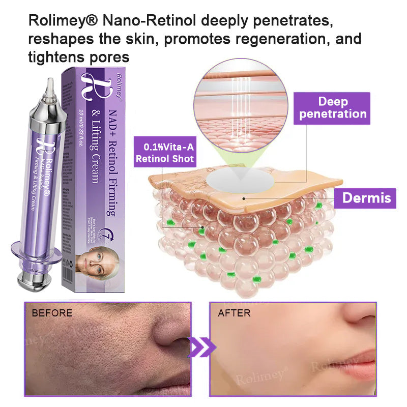 ✨ 💫Rolimey® NAD+ Retinol Firming & Lifting Cream – For Eye Bags, Dark Circles & Fine Lines | Last Day Sale: 60% OFF