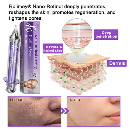 ✨ 💫Rolimey® NAD+ Retinol Firming & Lifting Cream – For Eye Bags, Dark Circles & Fine Lines | Last Day Sale: 60% OFF