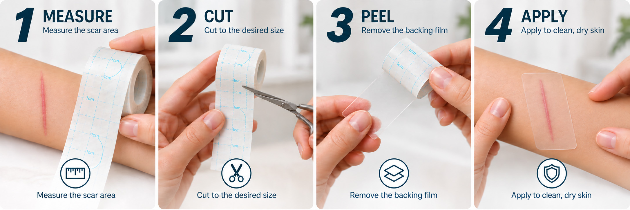 Four steps to measure, cut, peel, and apply silicone scar tape